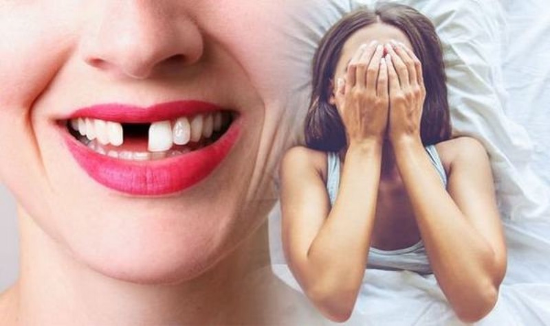 Chiêm bao thấy người yêu bị rụng 2 chiếc răng cửa mà không biết nguyên nhân